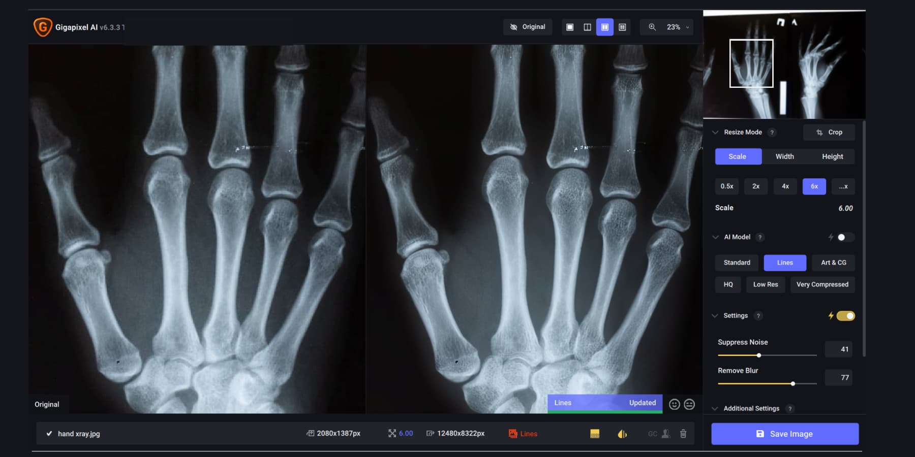 A screenshot of Gigapixel AI's enhancing an X-ray image of somebody's hand