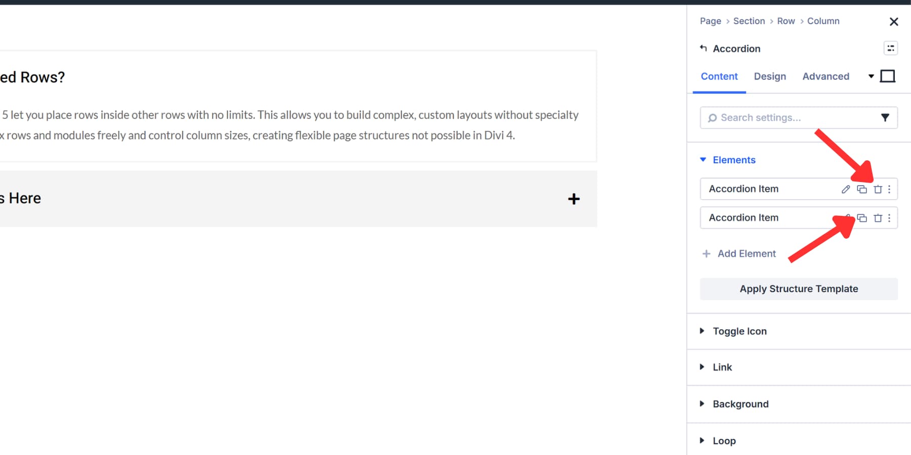 A screenshot of the duplicate and delete accordion items on Divi 5